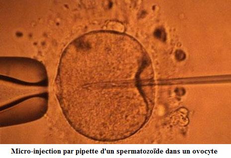 Micro-injection d'un spermatozoïde dans un ovocyte
